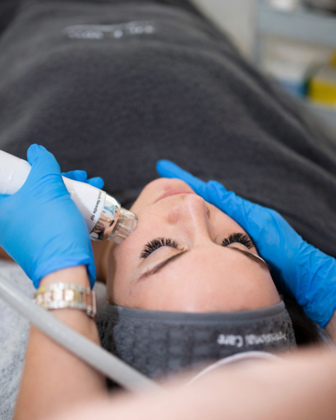 rf-microneedling-ciim