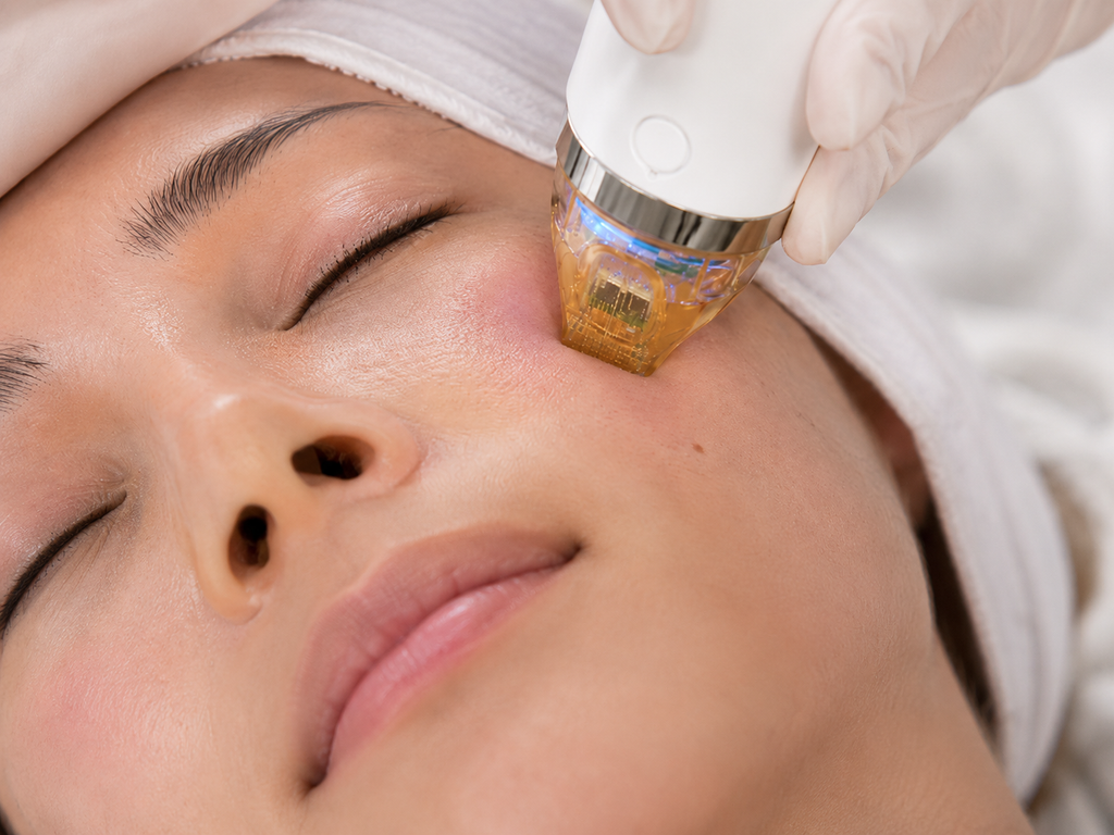 Tretma radiofrekvenčnega (RF) microneedlinga