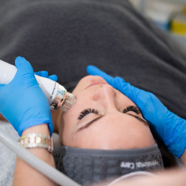 rf-microneedling-ciim