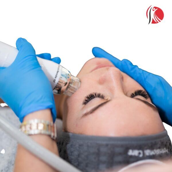 radiofrekvenčni-microneedling2